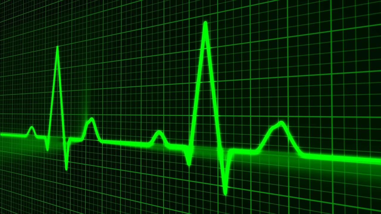 How to Choose the Perfect Pet Health Monitoring Device